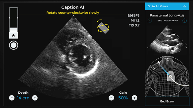 nvidia-caption-health-ai-ultrasound Image